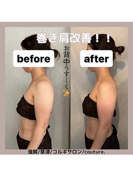 クチュール(couture.)/デコルテ、お背中の施術