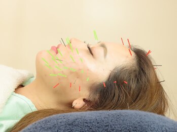 ノア鍼灸整骨院(NOA鍼灸整骨院)/