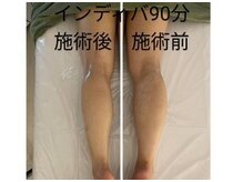 イワキ(INBEST IWAKI)の雰囲気（足のむくみもごらんの通り！足取り軽やかに〇）