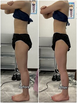 輝 らいと/ビフォーアフター(横)