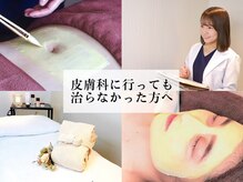 アクール(Accueil)