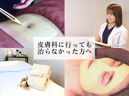 アクール(Accueil)の写真