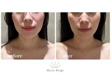 ハリーベージュ(Hariy Beige)/HariyBeige麻布十番