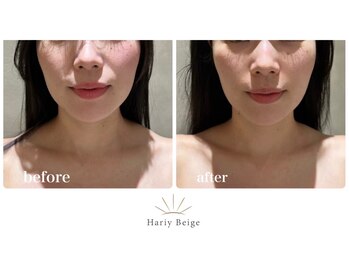 ハリーベージュ(Hariy Beige)/HariyBeige麻布十番