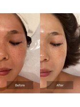 マインエム(mine.m)/