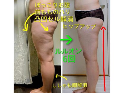 ヨサパーク モックス 堺東(YOSA PARK MOX)の写真