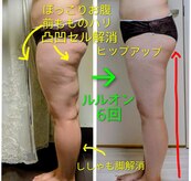 ヨサパーク モックス 堺東(YOSA PARK MOX)