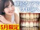 LBSホワイトニング 梅田店の写真