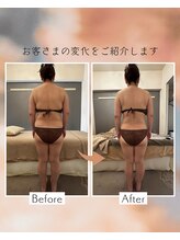 アイシー(I Sea)/バザルトボディ