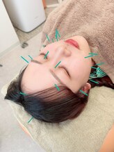 ヒーリングサロン アージュ(A-je)/★美顔鍼＋小顔矯正★