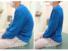 カイロライン 神楽坂通り整体院/頭痛×猫背矯正/beforeafter