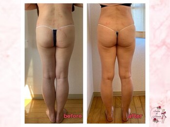 サロンドモアロ(Salon de Moaro)/Before/After