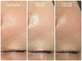 テルヒブール(terhibur)/