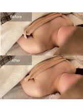 ハートランド(HEARTLAND)/ガチガチ肩こりが変わる