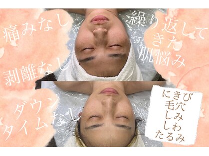 ぷるるりぶーるの写真