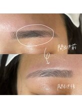 ビューティーアイ(beauty eye)/間引き