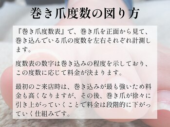 巻き爪料金の仕組み