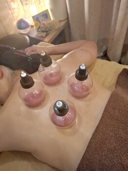 今日はいい日だセラピールーム (Room)/吸い玉