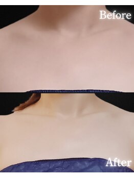 サンティエ(Santie)/人気★ブライダルケア