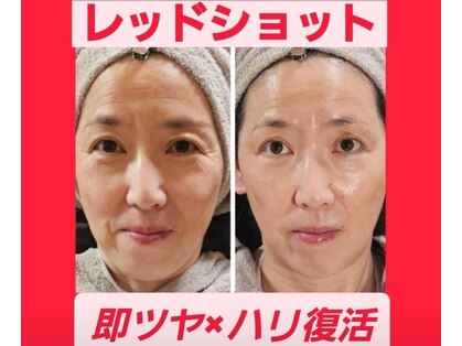 アン 銀座(ann)の写真