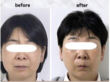 サロンスマイルの雰囲気（美容鍼１０回で小顔効果【リンパ/小顔/美容鍼/小顔矯正】）