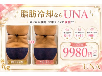 ウナトゥルービューティー(UNA true beauty)の写真/人気No.１★脂肪冷却４エリア44,000円→9,980円！！！