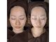 ECLA　塚口【黄土漢方よもぎ蒸し/毛穴/フェイシャル】の写真/【お肌悩みの相乗効果♪】本格黄土よもぎ蒸し×極上フェイシャルでお肌悩み改善◎毛穴/シミたるみ/肌荒れ