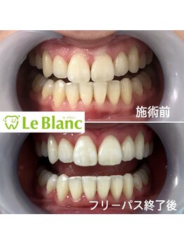ルブラン 奈良店(Le Blanc)/各種コース