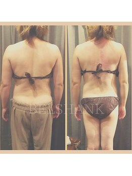 カラダ専家 恵びす(KARADA専家)/短期間で激変2