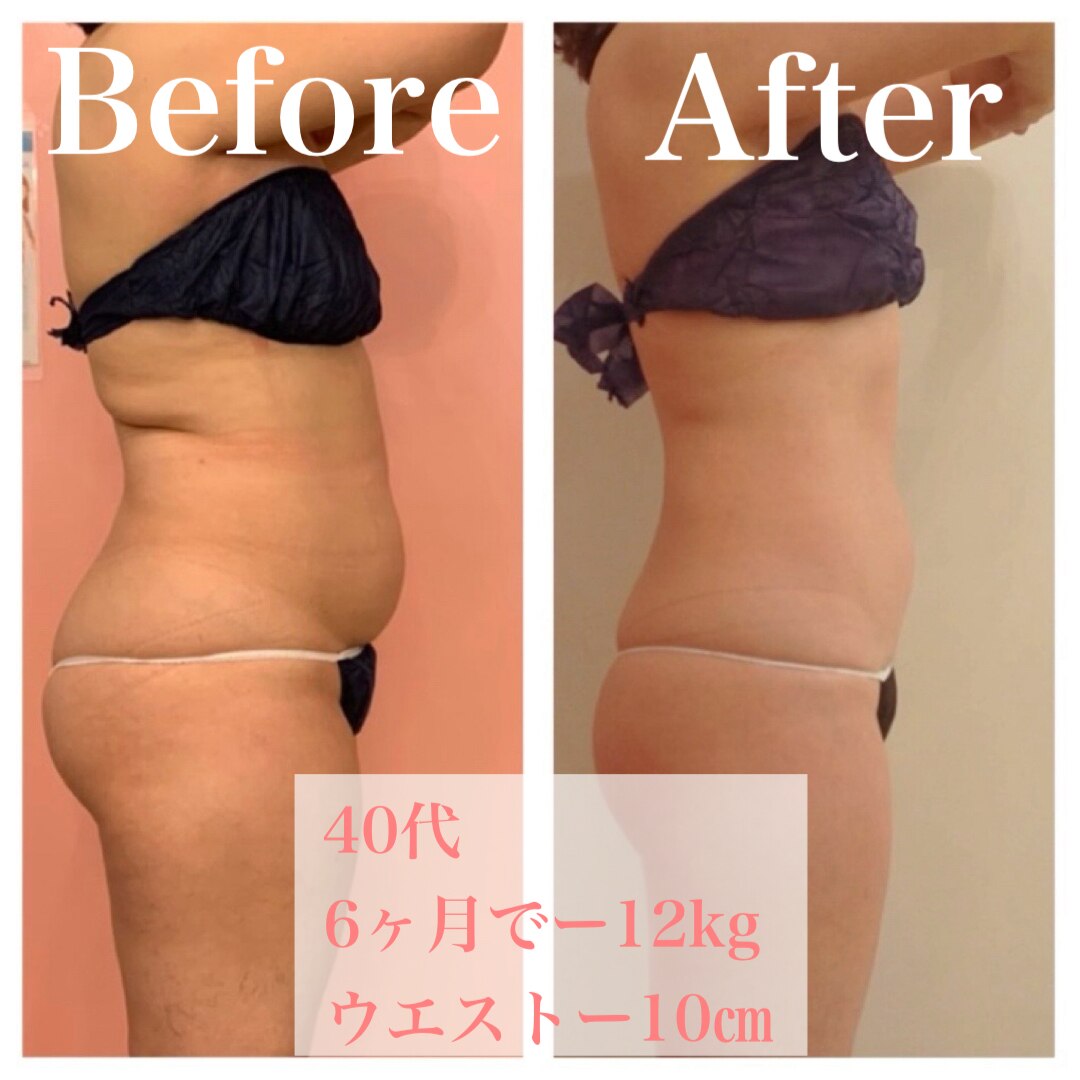 【新品未開封】PSクリーム等　サロン専売品スキンケア　ダイエットサロンクイーン トータルビューティサロン クイーン(Queen)｜ホットペッパービューティー