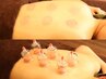 【血行促進】 本格カッピング65分☆女性限定☆