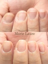 マリーロール 淀屋橋本店(Marie Laure)/自爪育成/深爪矯正/ネイルケア