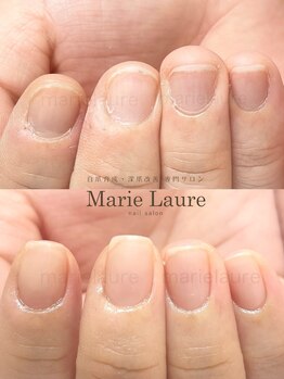 マリーロール 淀屋橋本店(Marie Laure)/自爪育成/深爪矯正/ネイルケア