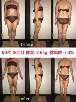 シェイプ 浜松本店/60代もシェイプでダイエット