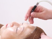 ユーフォリア(Euphoria)/キッシング(吸引）