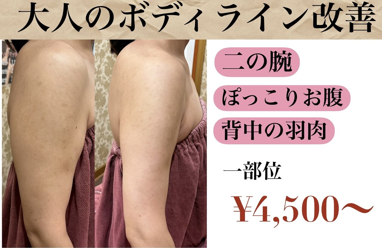 ヴィクトワール シュエット｜ホットペッパービューティー