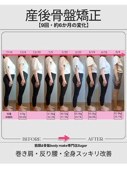 シュガー 津市(Sugar)/BeforeAfter【産後骨盤矯正】
