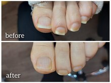 爪切り屋 足楽/定期的な足爪切り