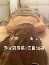 フラーダヴィータ(hlaada.vita)/巻き肩・姿勢矯正で華奢見え！