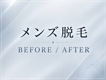 エルミューノ(elμno)/こちらからメンズの症例です
