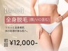 【人気No.2★レディース脱毛】全身脱毛（顔/VIO込み）初回15,000円→12,000円