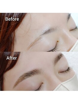 マツ(MATSU)/【ハリウッドブロウリフト】