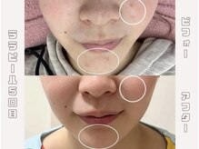 アイル 博多祇園店(iru)/