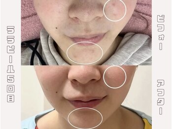 アイル 博多祇園店(iru)/