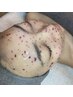 《艶肌管理》大人気の艶肌FACEwax＋ハイドロジェリーマスク　￥8,800