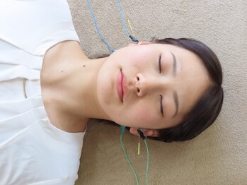 ハリータイムの写真/【小顔効果を実感】わずか4本の鍼でお顔にアプローチ◎むくみ・たるみを徹底改善で小顔へ！