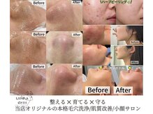 ルミナエステ(LUMINA ESTH)