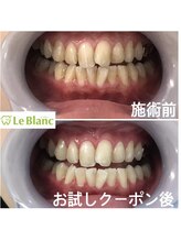 ルブラン 奈良店(Le Blanc)/口臭予防にもなります