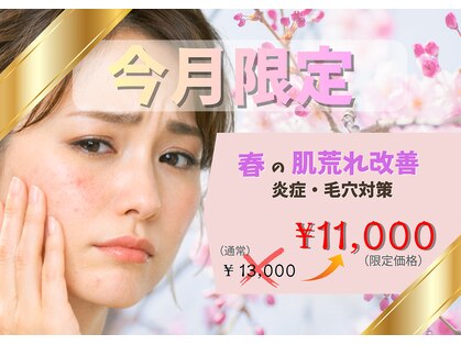 アールビューティー(R-beauty)の写真
