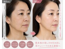 ルナ クレッシェンテ(Luna crescente)/疲れ顔を短時間で解消マッサージ